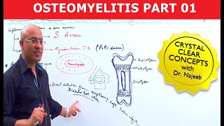 Acute Osteomyelitis  Orthopedics for Medical Students [upl. by Dleifrag159]