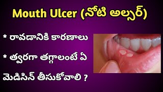 Mouth Ulcers Reasons and Treatment in Telugu [upl. by Nallij]