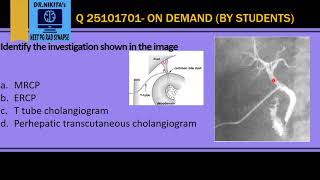 Bile duct stones When is ERCP indicated [upl. by Farrow]