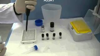 Phosphatase assay Microcystest [upl. by Ekul]