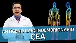 Antígeno Carcinoembrionário  CEA Marcador tumoral  IMEB [upl. by Ojadnama625]