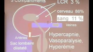 TRAUMATISME CRANIEN [upl. by Anirbaz]