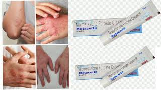 Metacortil Cream Mometasone Furoate Cream IP [upl. by Kirbee]