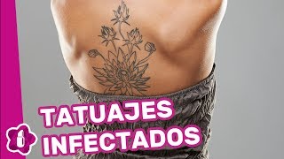 Tatuajes infectados cómo curarlos [upl. by Tarsus]