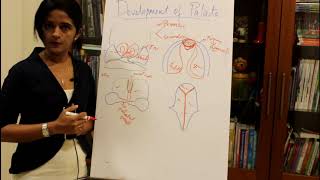 developmental disturbances of teeth part 1 [upl. by Herb]