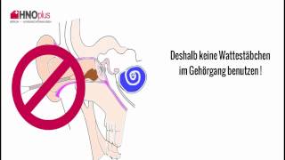 Ohrenschmalz  5 häufige Fragen aus der HNO Praxis [upl. by Annoynek]