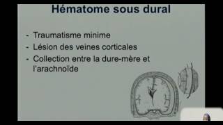 FMPM MOOCs  Exploration radiologique des traumatismes crâniens  Pr Idrissi [upl. by Omora]