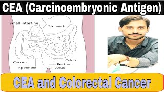 CEA Test  Carcinoembryonic Antigen [upl. by Ellette]