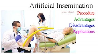 Artificial Insemination in humans I Procedure types Advantages Disadvantages and Applications [upl. by Adamson]