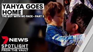 Yahya Goes Home The boy with no face Part III  7NEWS Spotlight [upl. by Marchak]