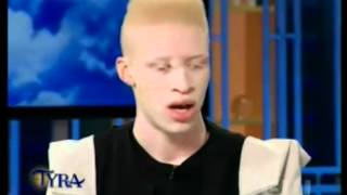 Albino Models on Tyra show [upl. by Nehcterg687]