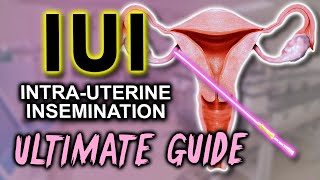 IUI  Fertility expert secrets for maximum pregnancy rates [upl. by Adnilem]