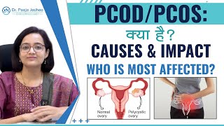 PCODPCOS  क्या होता है  PCOS Causes amp Types  By Dr Pooja Jadhao [upl. by Darbie]