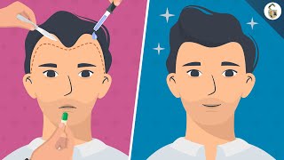 Hair Loss Treatments For Men According To Science [upl. by Yssej704]