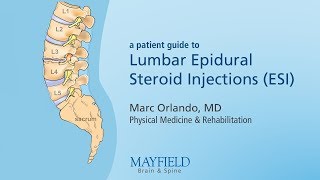 Lumbar Epidural Steroid Injections [upl. by Enyleve]