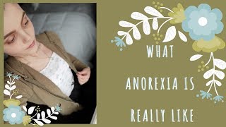 what anorexia is really like [upl. by Jesher]