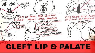 Embryology of the Face Easy to Understand [upl. by Ateekan]