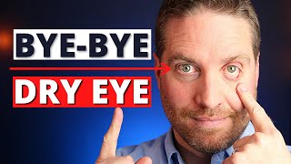 How To Get Rid Of Dry Eyes  4 Advanced Home Treatments [upl. by Trebo618]