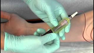 Sample Procedure  Venipuncture Butterfly Method [upl. by Nitsyrc459]