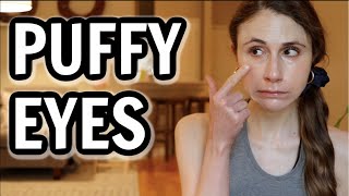 How to get rid of puffy eyes Dr Dray [upl. by Admama629]