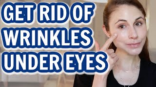 How to GET RID OF UNDER EYE WRINKLES Dr Dray [upl. by Gnous862]