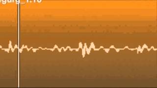 Echocardiogram Aortic Dissection [upl. by Pepito]