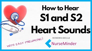 How to Hear S1 and S2 Heart Sounds [upl. by Nisbet616]