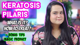 KERATOSIS PILARIS  KP  WHAT WHY TREATMENT amp TIPS  MAGIC CURE  MAITRAYEE HALDER [upl. by Rochus]