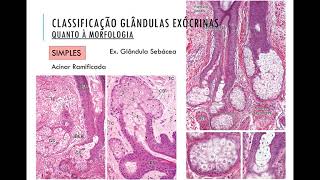 4 tecido epitelial glandular médio c [upl. by Lorry]