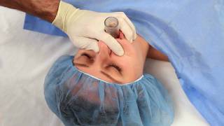 NuMask in Anesthesiology IntraOral Mask IOM®  Oropharyngeal Airway OPA Training Video [upl. by Archambault]