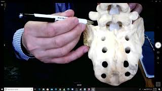 S1 pedicle screw placement tips and tricks EXTENDED [upl. by Notsgnal]