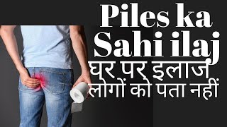 Piles treatment at home in Hindi  Bavasir ka ilaj [upl. by Kramal]