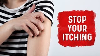 What Causes Hives and Itchiness  Urticaria Hives Treatment  Dr Berg [upl. by Melamed166]