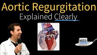 Mitral Stenosis and Aortic Insufficiency Jason C Tippett MD [upl. by Bish]