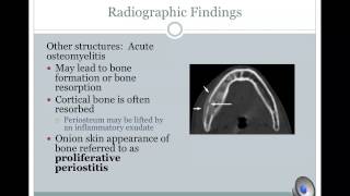 Osteomyelitis  etiopathogenesis and classification [upl. by Atrebor842]