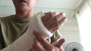 Gamekeepers thumb injury [upl. by Llerej]