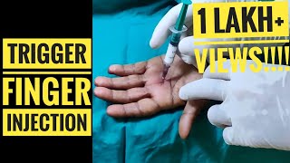 Trigger Finger Injection Technique [upl. by Lael]