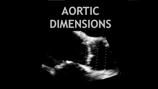 How to measure the AORTA Echocardiogram [upl. by Ailenroc]