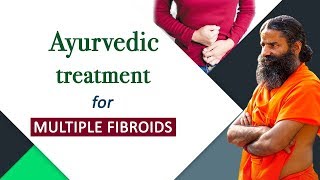 Ayurvedic Treatment for Multiple Fibroids  Swami Ramdev [upl. by Ardnohsed632]