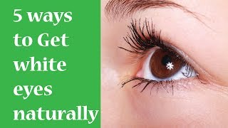 Adapt These 5 Ways To Get White Eyes Naturally [upl. by Ekrub144]