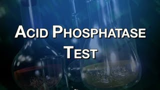 Acid Phosphatase Test [upl. by Aicilf]