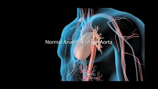 Ultrasound of Abdominal Aortic Aneurysm AAA [upl. by Tinor]