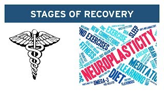 The 2Stage Recovery Process for Vestibular Disorders [upl. by Euqinomad617]