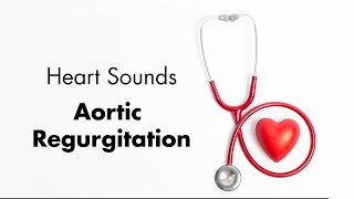 Whats Aortic Atherosclerosis [upl. by Auhs202]