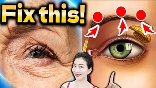 3 Point Massage That Guarantees to Erase Wrinkles and Sagging Around Eyes amp Temples [upl. by Vernen307]