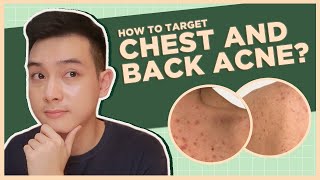 Get rid of CHEST amp BACK ACNE BEST PRODUCTS  DOs and DONTs Filipino  Jan Angelo [upl. by Leciram735]