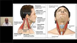 Neck lumps in general practice [upl. by Padegs]