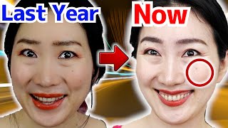 How I got Higher Cheeks Than Last Year with Very Simple Exercise [upl. by Worthy671]