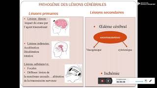 Traumatisme cranien Pr Daoud [upl. by Persons]