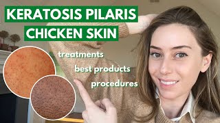 Keratosis Pilaris How to treat dry bumpy skin aka chicken skin  Dr Shereene Idriss [upl. by Wunder823]